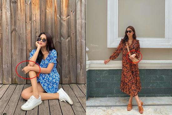 Tăng Thanh Hà mặc váy rộng thùng thình vẫn khí chất ngời ngời nhưng nhìn đến tay chân mà phát hoảng