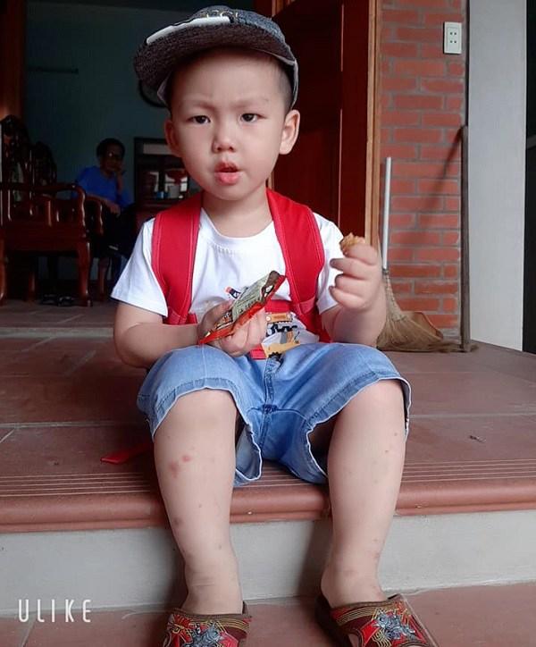 Em bé chào đời với cân nặng kỷ lục 7.1kg ở Vĩnh Phúc 3 năm trước hiện giờ ra sao?-1