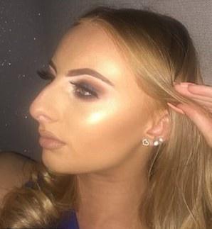 Cô gái không dám yêu ai vì có mũi cá mập-1