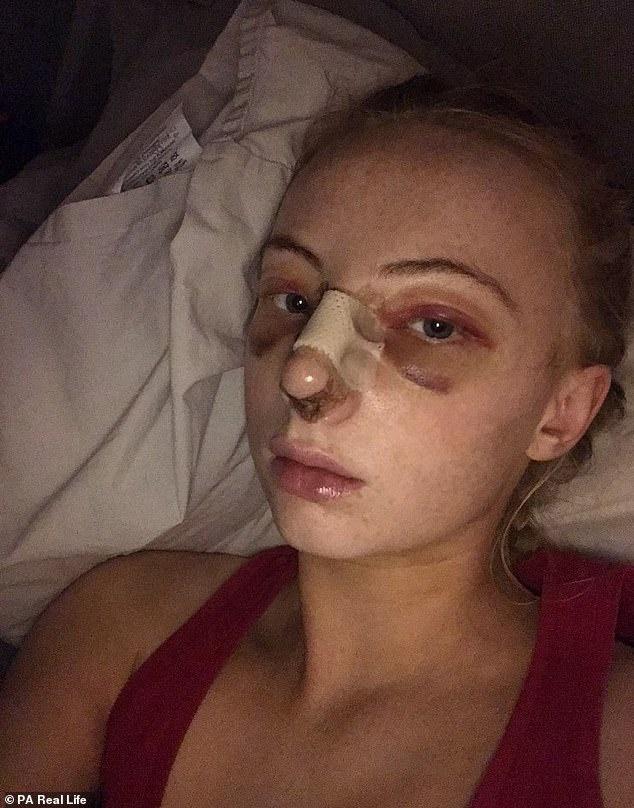 Cô gái không dám yêu ai vì có mũi cá mập-3