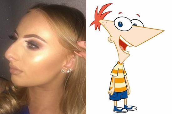 Cô gái không dám yêu ai vì có mũi cá mập