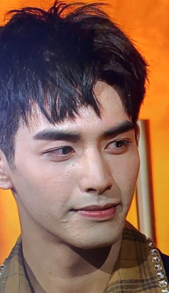 Sáng nhất Kim Ưng đêm nay là làn da sần sùi mụn đến gai người của Tống Uy Long-1