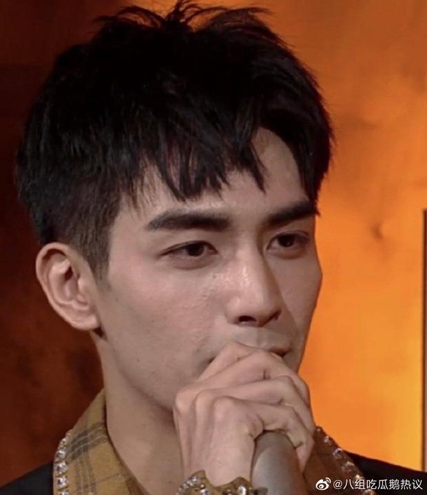 Sáng nhất Kim Ưng đêm nay là làn da sần sùi mụn đến gai người của Tống Uy Long-4