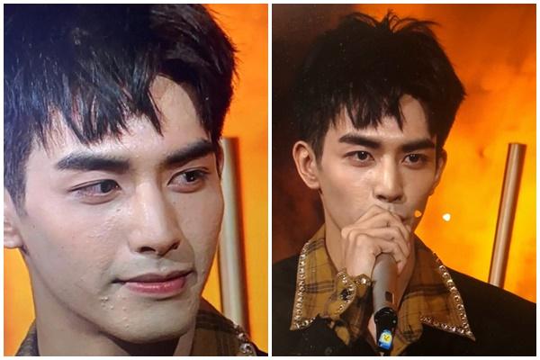 Loạt mỹ nam Hoa ngữ bị bóc làn da lỗ chỗ, đầy mụn-13