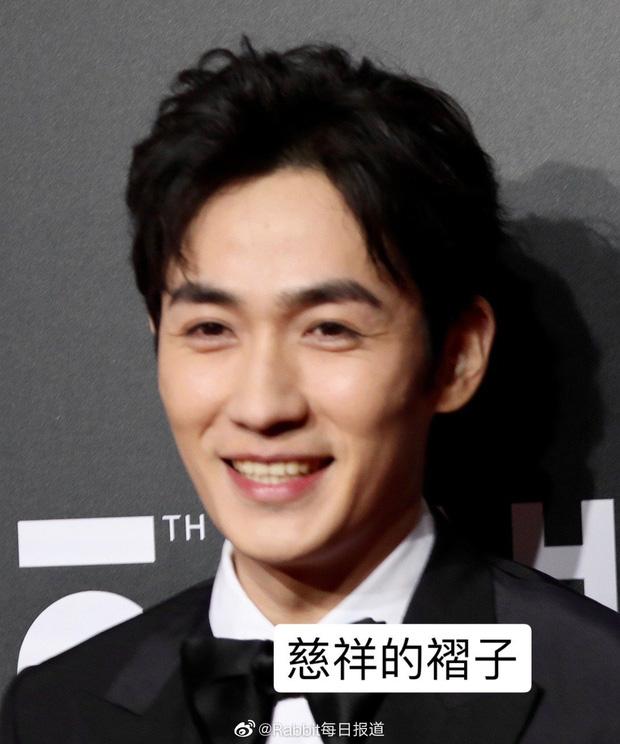 Loạt mỹ nam Hoa ngữ bị bóc làn da lỗ chỗ, đầy mụn-8