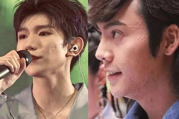 Riêng gì Thủy Tiên bị ghẻ vì ngâm nước, Hương Giang cũng có chân hoa gấm-13