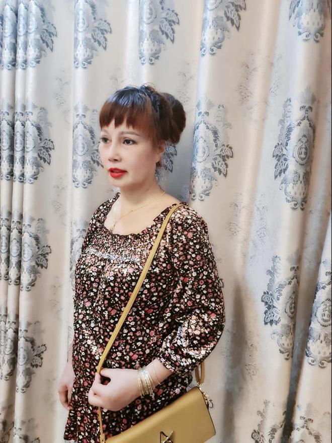 Bất ngờ gương mặt trẻ đẹp của cô dâu Cao Bằng sau gần 4 tháng dao kéo-5