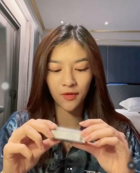 Á hậu Kiều Loan tiêm cằm nhọn hoắt như mặt rắn-3