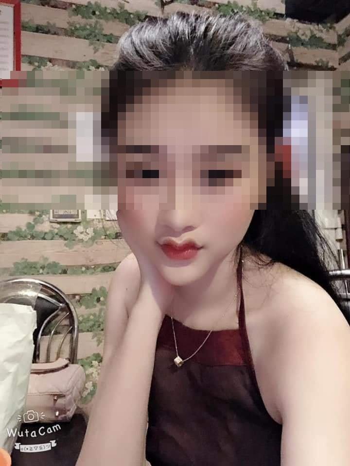 Những pha thẩm mỹ môi trái tim nhìn mà hốt, có nàng còn không khép được môi-5