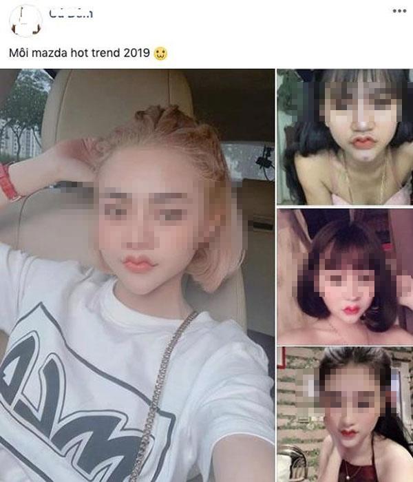 Hết hồn đôi môi đại bàng tung cánh của cô gái trẻ sau phẫu thuật-1