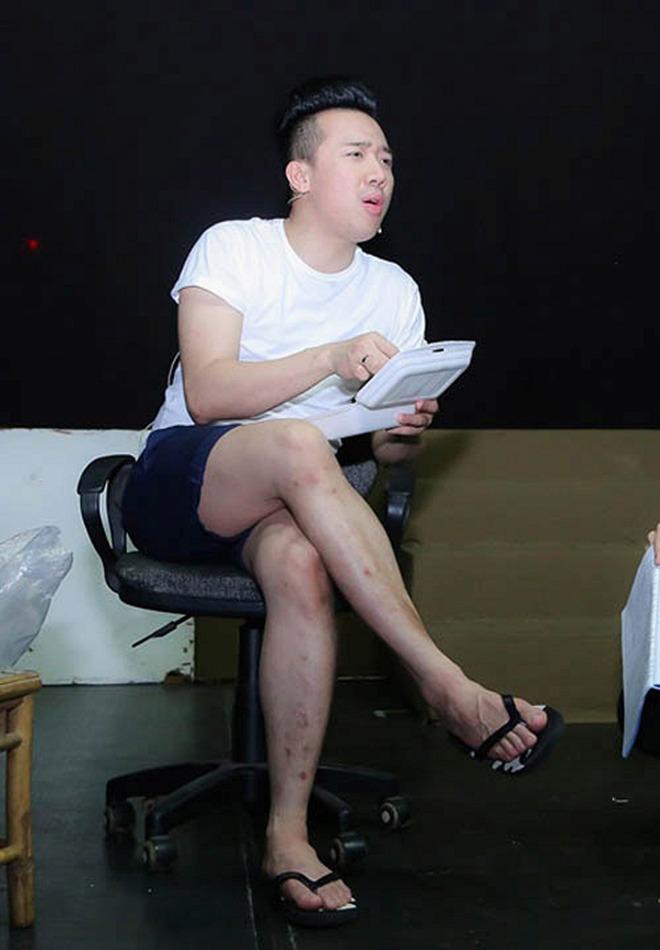 Riêng gì Thủy Tiên bị ghẻ vì ngâm nước, Hương Giang cũng có chân hoa gấm-9