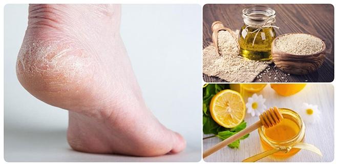 Riêng gì Thủy Tiên bị ghẻ vì ngâm nước, Hương Giang cũng có chân hoa gấm-10