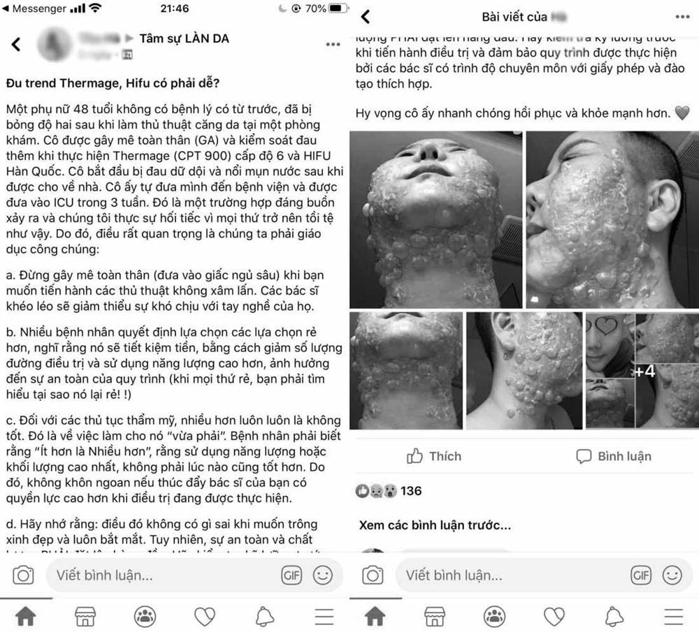 RÙNG MÌNH: Mặt rộp như bánh đa sau khi căng da bằng phương pháp Hifu-1