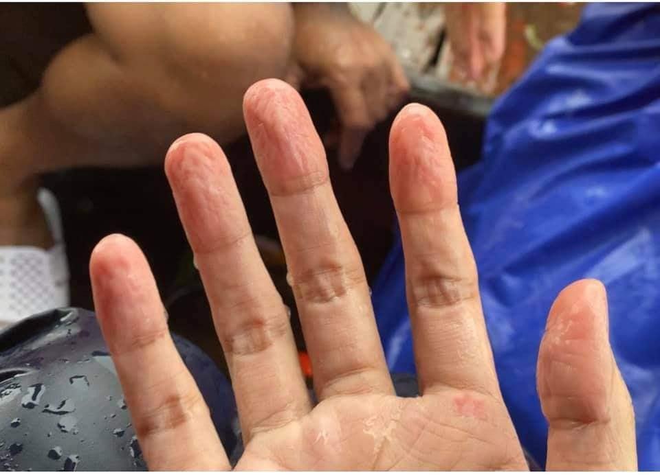 Xót xa đôi tay nhăn nheo như bà cụ, chân lội nước ghẻ lở của Thủy Tiên-2