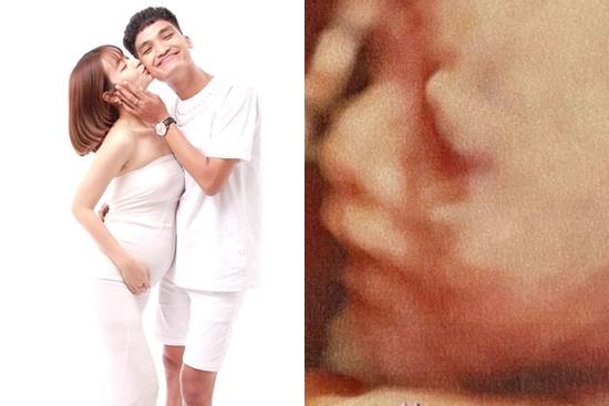 Bạn gái Mạc Văn Khoa công khai ảnh siêu âm thai, tiết lộ giới tính em bé