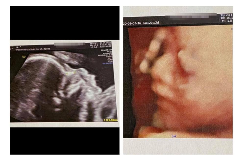 Bạn gái Mạc Văn Khoa công khai ảnh siêu âm thai, tiết lộ giới tính em bé-2