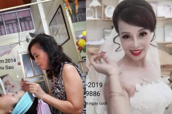 Gương mặt méo lệch của cô dâu 63 tuổi ở Cao Bằng sau nửa năm đại phẫu-5