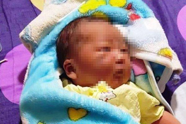 Bé trai 4 tháng tuổi mắc đa dị tật bị bỏ rơi trước cổng chùa-2