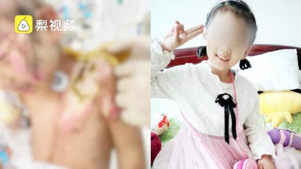 Bé gái 6 tuổi bị mẹ ruột và nhân tình hành hung, lấy kìm bẻ răng rồi bắt nuốt-1