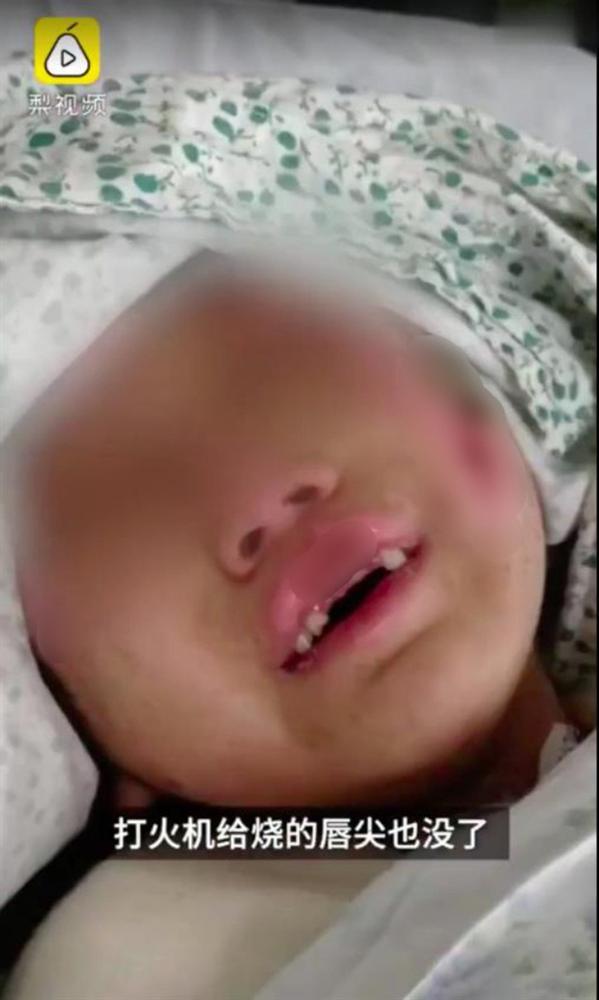 Bé gái 6 tuổi bị mẹ ruột và nhân tình hành hung, lấy kìm bẻ răng rồi bắt nuốt-2