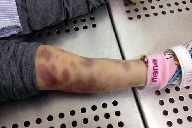 7 luật sư bào chữa cho cặp vợ chồng bị cáo buộc giết con-1