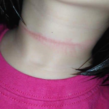 Bé gái 4 tuổi suýt mất mạng vì treo cổ tự tử theo thử thách trên Tiktok-1