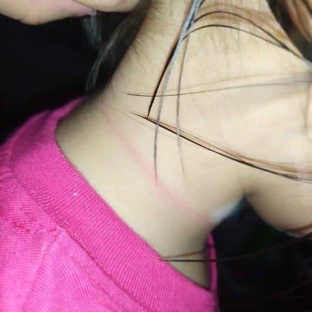 Bé gái 4 tuổi suýt mất mạng vì treo cổ tự tử theo thử thách trên Tiktok-2