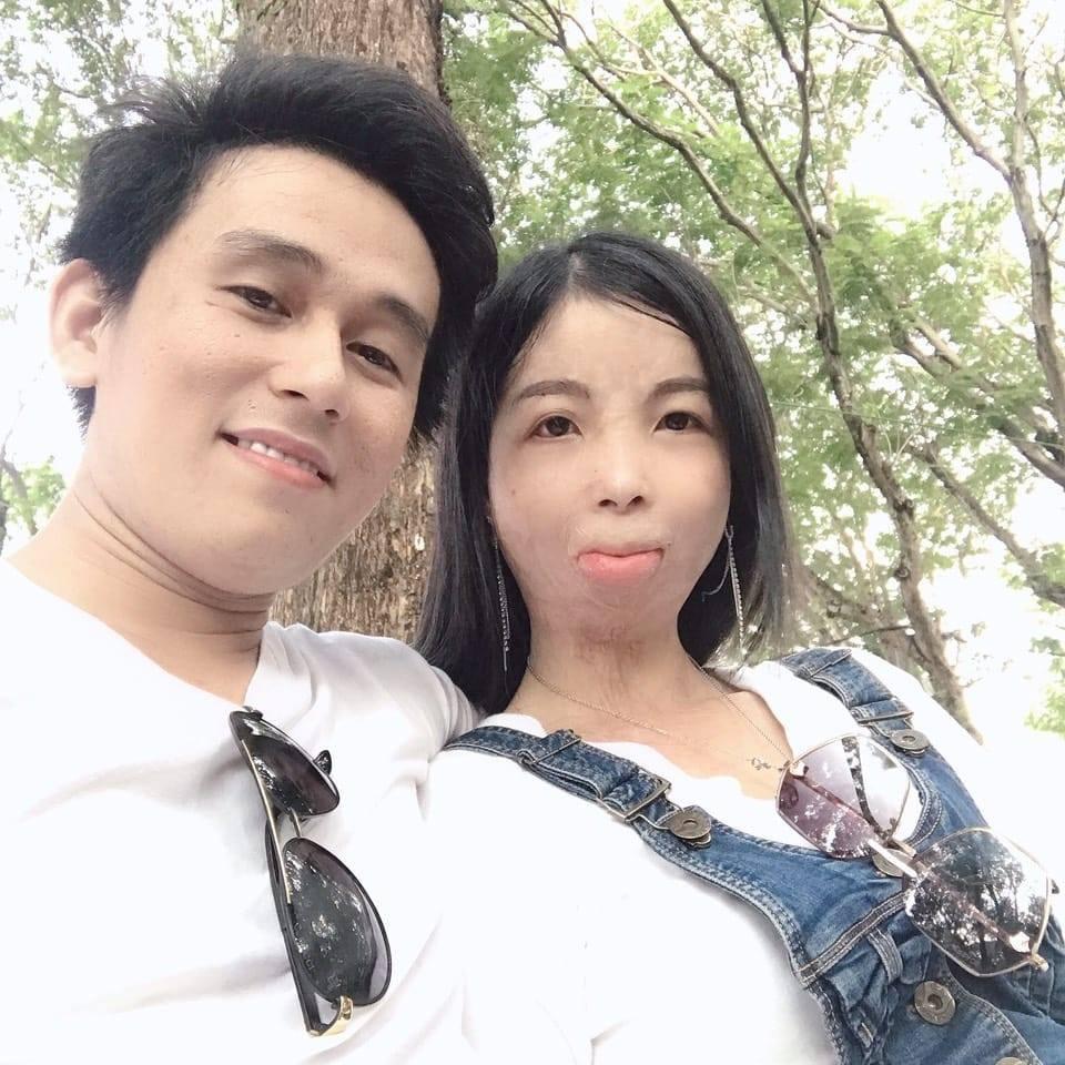 Tình yêu của cô gái có gương mặt biến dạng và chàng shipper-2
