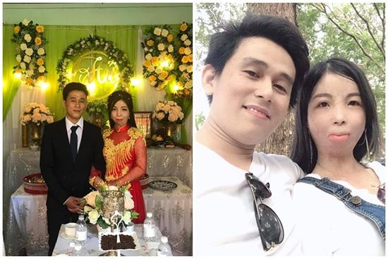 Tình yêu của cô gái có gương mặt biến dạng và chàng shipper