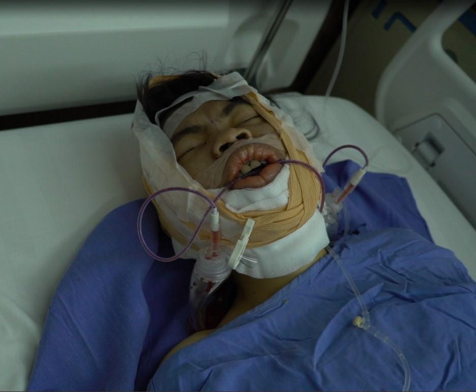 Nhờ chồng trông con để dao kéo 2 tháng, cô vợ lột xác thành hot girl-5