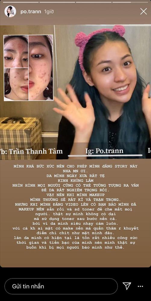 Hot girl trứng rán Thanh Tâm lấy hết can đảm khoe ảnh mặt mộc chi chít mụn-3