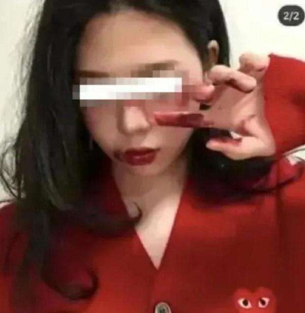 Loạt bạn trẻ xuất hiện với gương mặt bầm tím như bị bạo hành, tất cả do Halloween mà ra-3