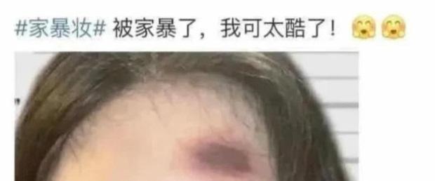 Loạt bạn trẻ xuất hiện với gương mặt bầm tím như bị bạo hành, tất cả do Halloween mà ra-1