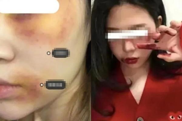 Nam sinh 16 tuổi bị hắt nước tiểu, án dành cho kẻ bắt nạt gây phẫn nộ-4