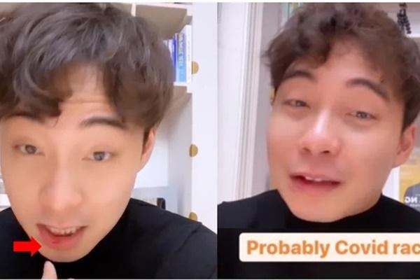 Nam vlogger bị đấm vào mặt vì là người châu Á-1