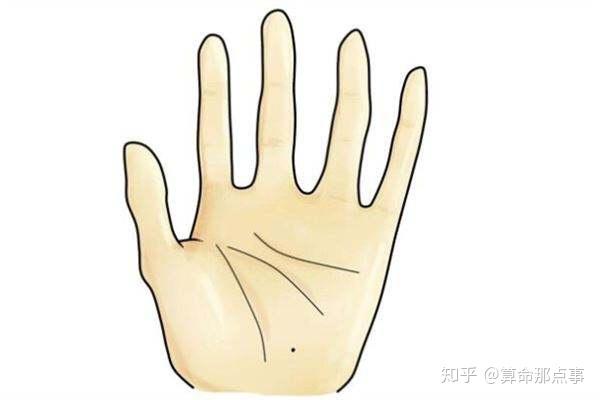 Phụ nữ sở hữu nốt ruồi cát tường này, cả đời không lo cơm áo gạo tiền, sau 30 tuổi sự nghiệp thăng hoa-1