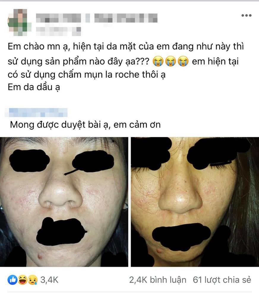 Giữa đêm đăng bài nhờ tư vấn da, cô gái khiến nhiều người sợ hãi quăng điện thoại-1