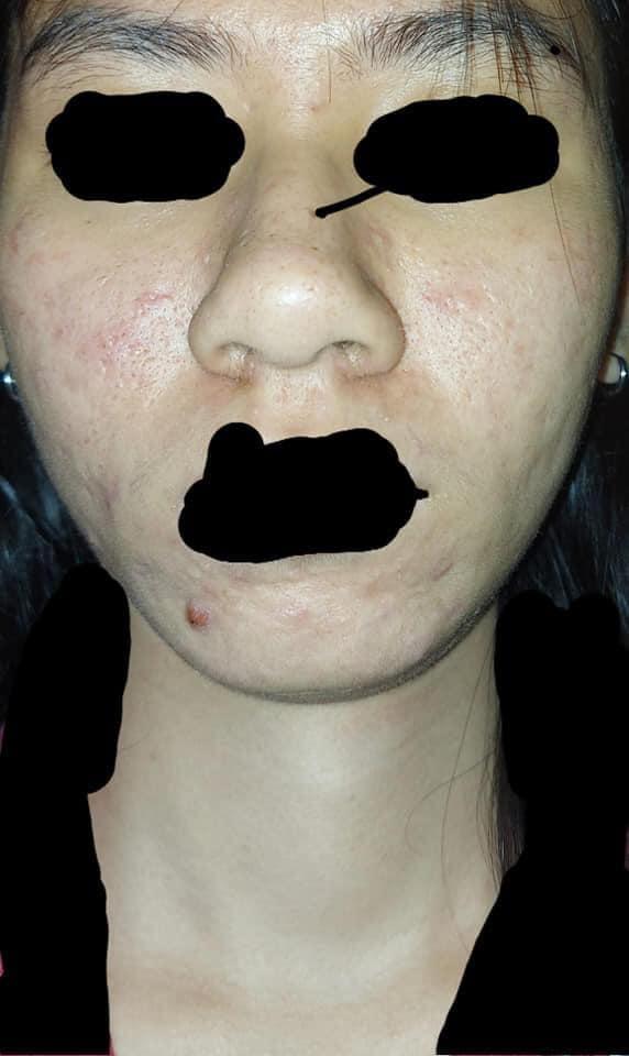 Giữa đêm đăng bài nhờ tư vấn da, cô gái khiến nhiều người sợ hãi quăng điện thoại-2