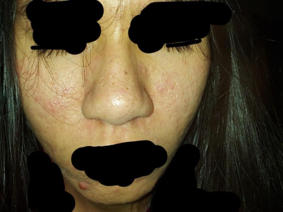 Giữa đêm đăng bài nhờ tư vấn da, cô gái khiến nhiều người sợ hãi quăng điện thoại-3