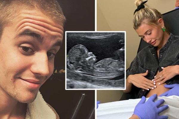 Justin Bieber: Vợ tôi sống nguyên tắc và trách nhiệm-5