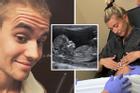 Bà xã Justin Bieber mang thai đứa con đầu lòng?