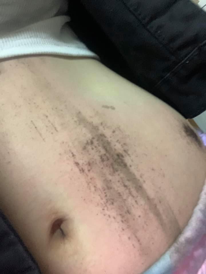 Lời kể của cô gái Sài Gòn bị kẻ cướp điện thoại kéo lê 3 mét trên đường-3