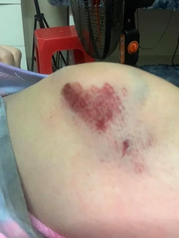 Gái xinh bị cướp kéo lê 3m bức xúc vì nhiều bình luận khiếm nhã: Có điên đâu-2