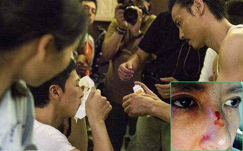 Cao thủ võ thuật là sư phụ Châu Nhuận Phát, đánh gãy mũi Chân Tử Đan, từ kẻ vô danh thành lập môn phái riêng-2