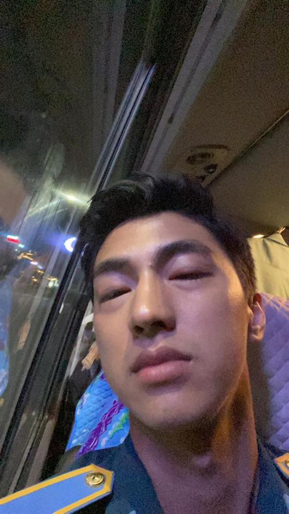 Bình An mặt sưng vù nhìn tưởng hài hước, sự thật khiến người thân lo lắng-1