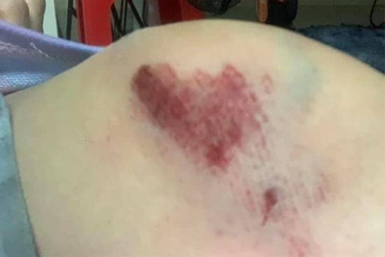 Cô gái bị cướp kéo lê ở TP.HCM