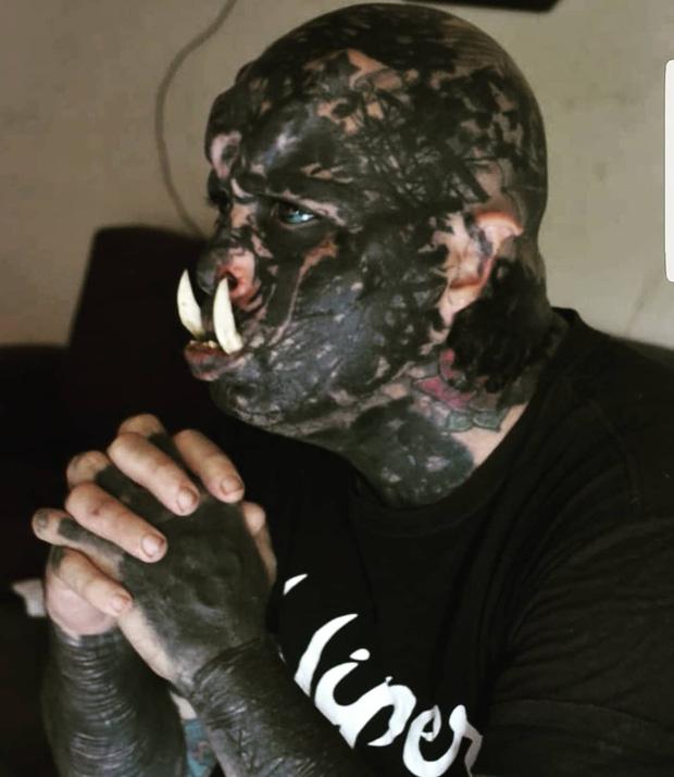 Chán làm người thường, thanh niên đập đi xây lại cả mặt và trồng răng nanh lợn lòi cho khác biệt-1