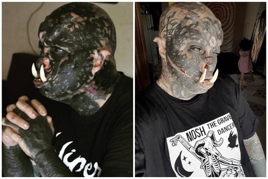 Chán làm người thường, thanh niên 'đập đi xây lại' cả mặt và trồng răng nanh lợn lòi cho khác biệt