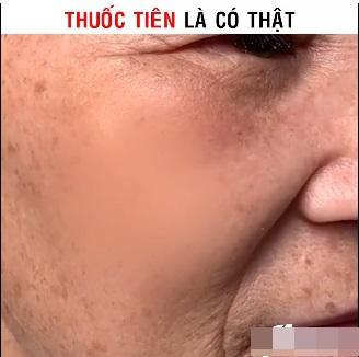 Pha quảng cáo thần dược xóa nhăn giả trân đến nỗi mất luôn cả lông mày-1