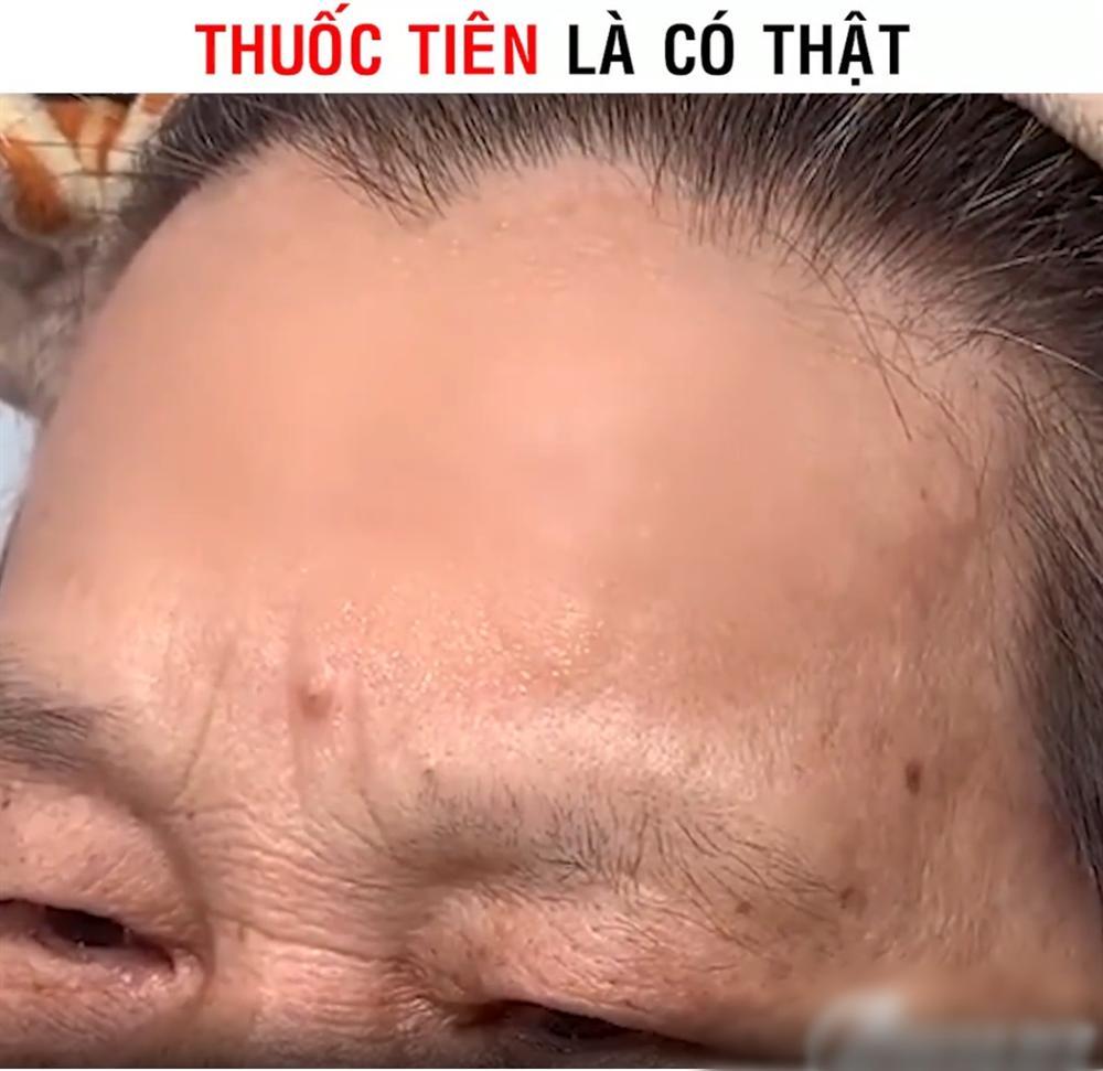 Pha quảng cáo thần dược xóa nhăn giả trân đến nỗi mất luôn cả lông mày-3